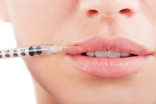 Filler acido jaluronico
