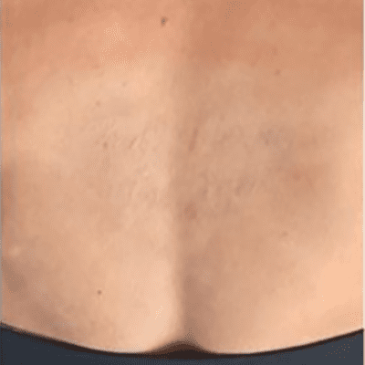 Dopo