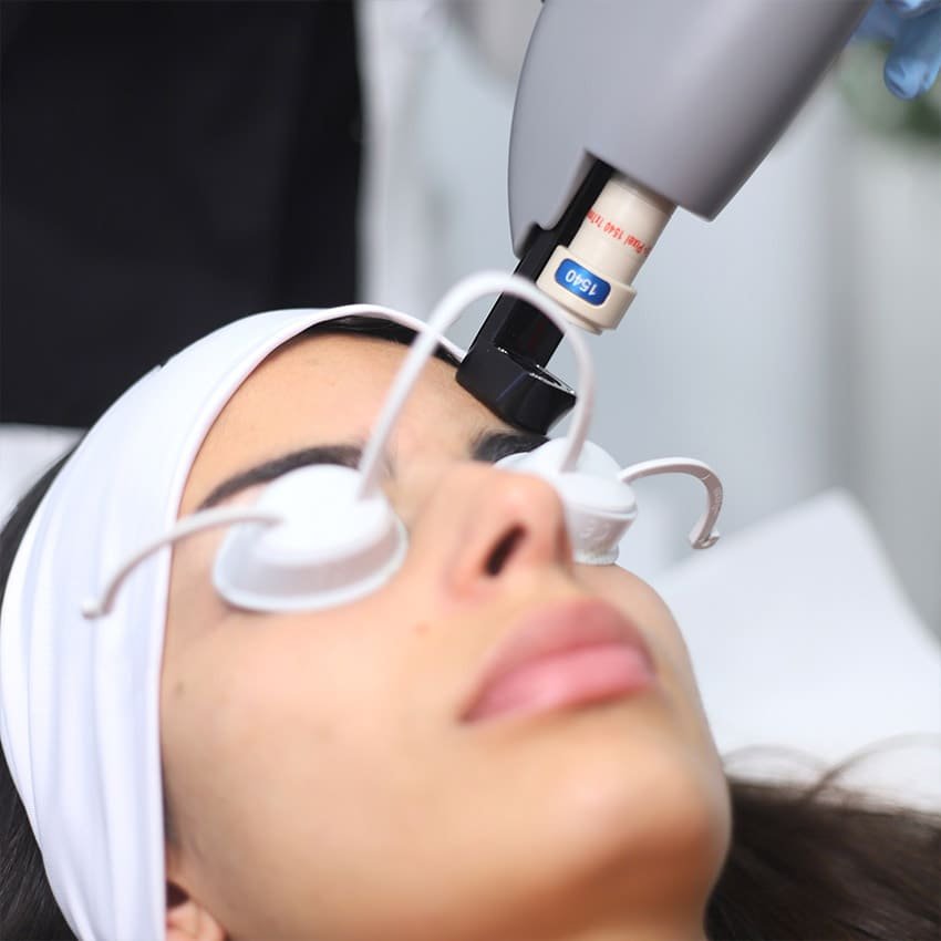 Laserterapia Milano