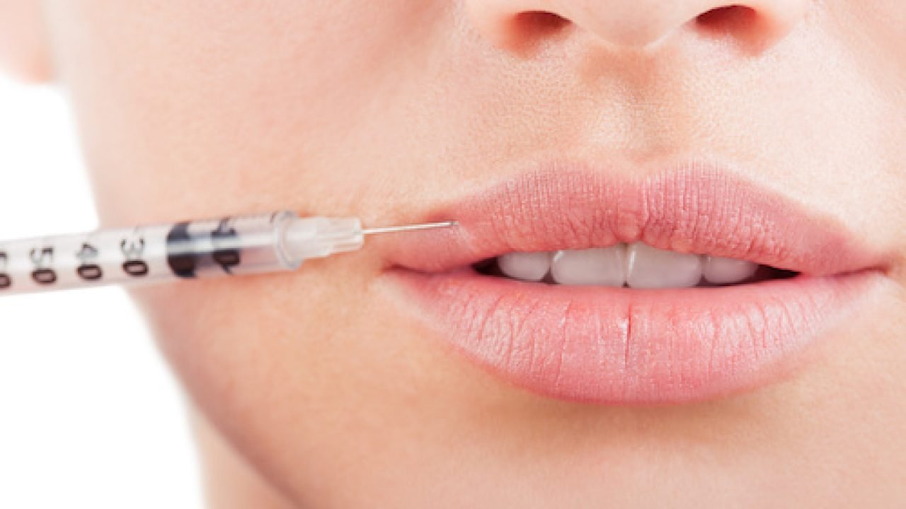 Filler acido jaluronico
