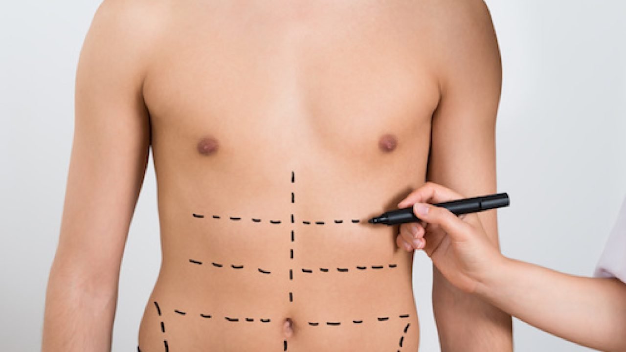 Vaser Lipo