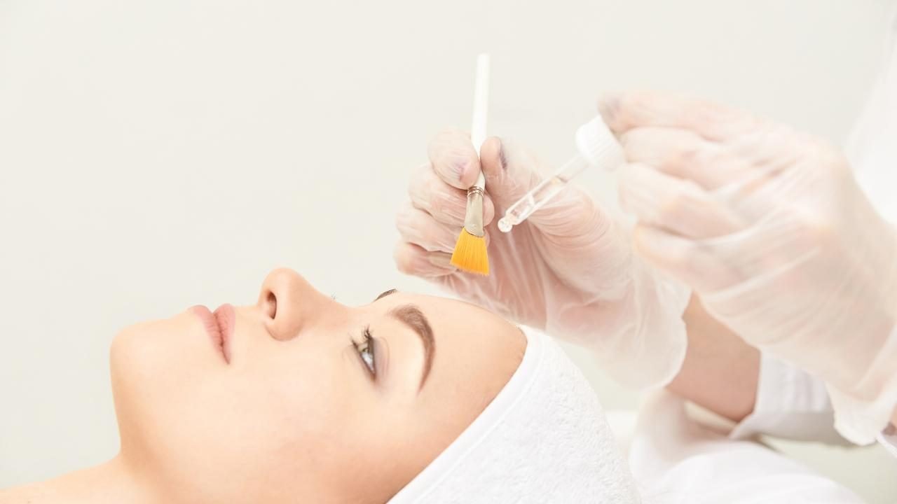 Peeling chimico viso